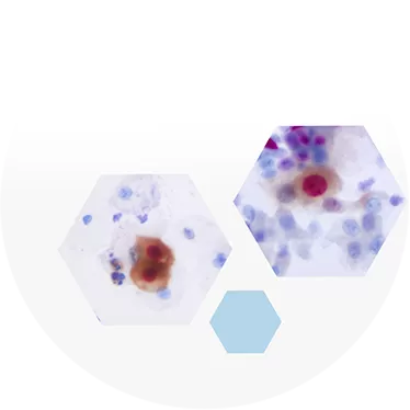 Immunocytochemistry