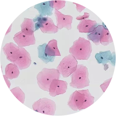 Liquid-Based Cytology