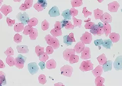 Liquid-Based Cytology