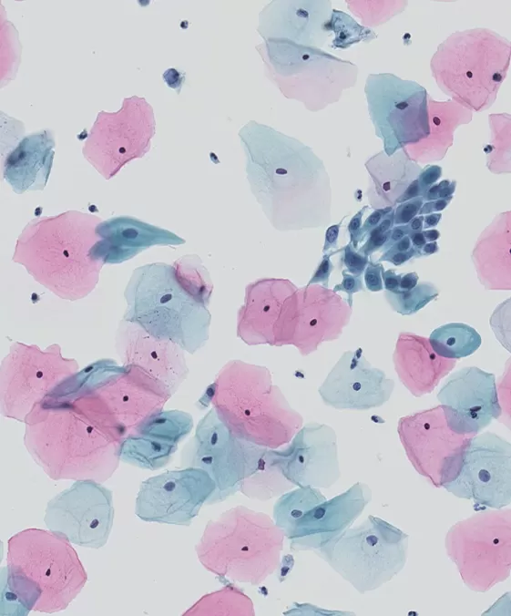 Liquid-Based Cytology Technique