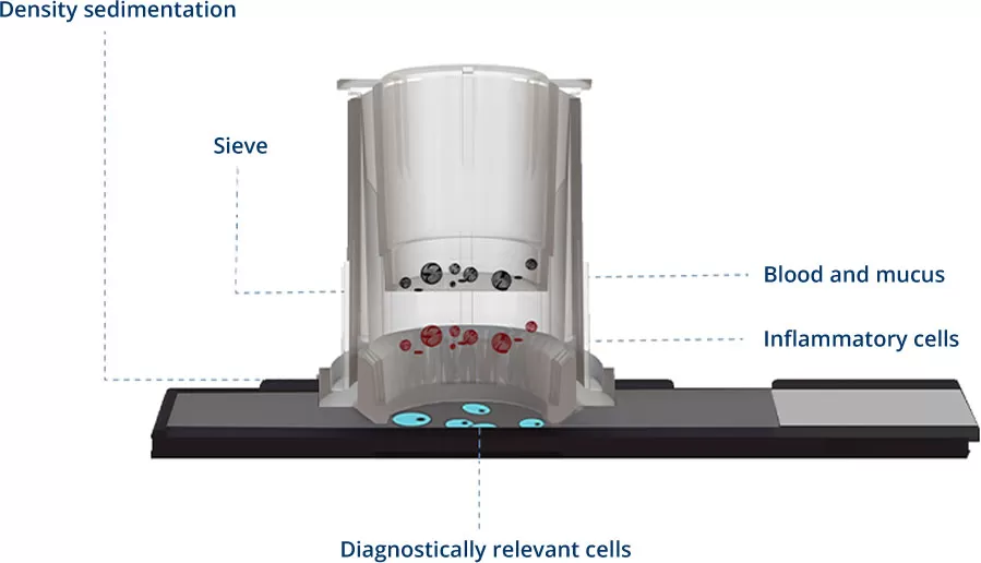 What is HealthSky SCT Method?