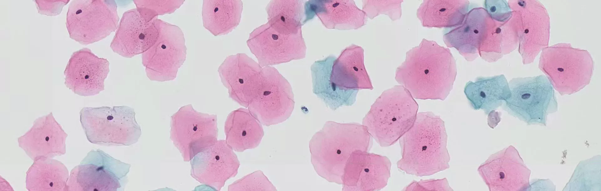 Liquid-Based Cytology