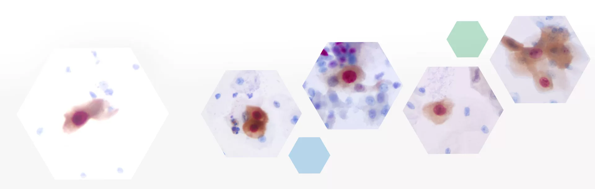 Immunocytochemistry