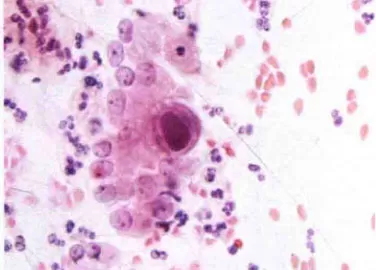 Cytomegalovirus.jpg Cytomegalovirus.jpg