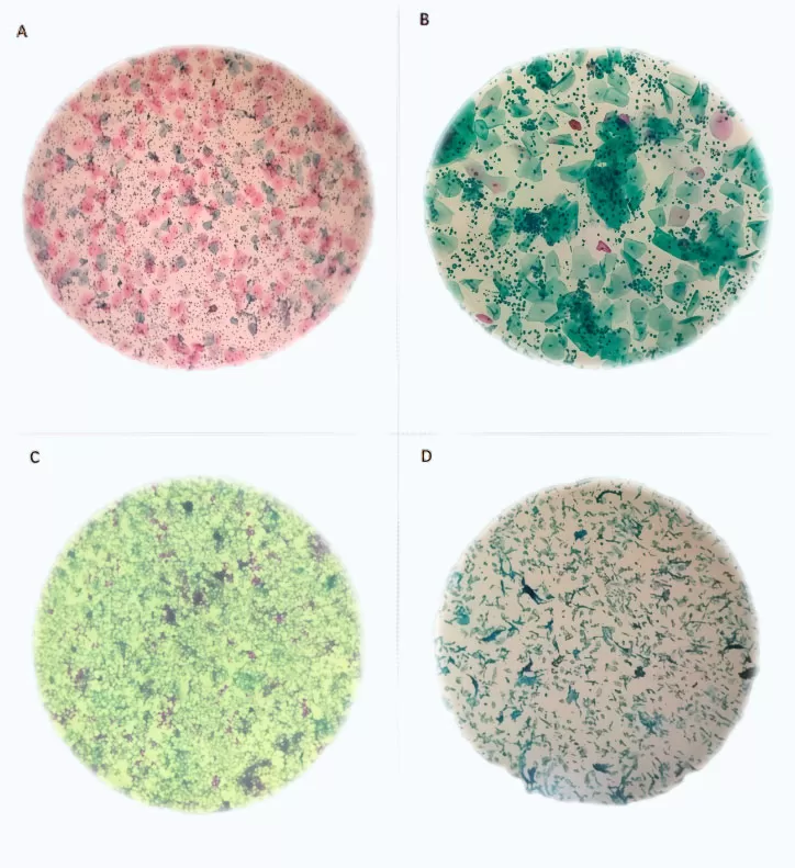 Slide-Preparation.jpg Slide-Preparation.jpg