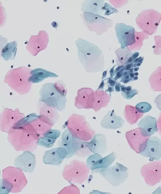 liquid-based-cytology-technique.jpg liquid-based-cytology-technique.jpg