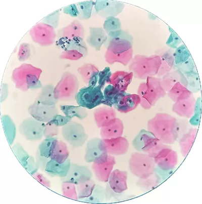 liquid-based-cytology.png